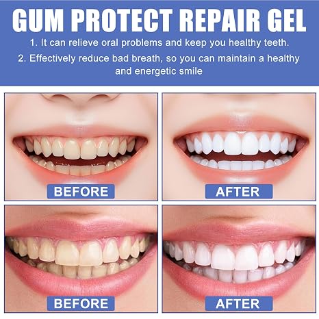 Prettyji-Gum Protect Dental Repair Gel